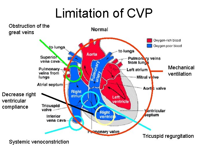 Limitation of CVP Obstruction of the great veins Mechanical ventilation Decrease right ventricular compliance