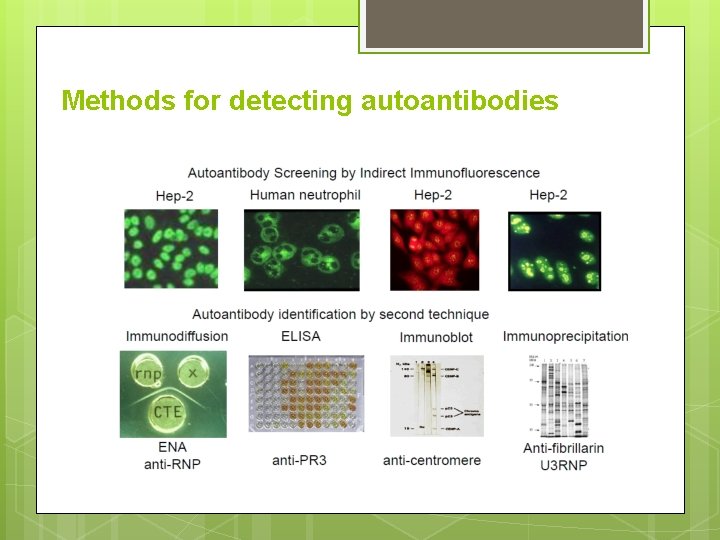 Methods for detecting autoantibodies 