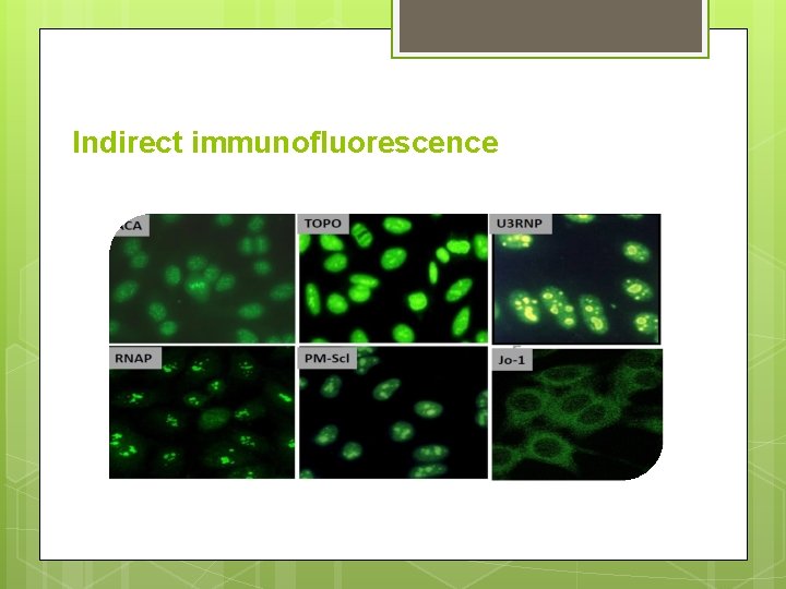 Indirect immunofluorescence 