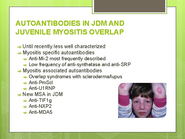 AUTOANTIBODIES IN JDM AND JUVENILE MYOSITIS OVERLAP Until recently less well characterized Myositis specific