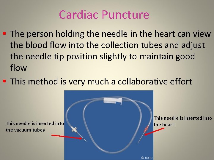 Cardiac Puncture § The person holding the needle in the heart can view the