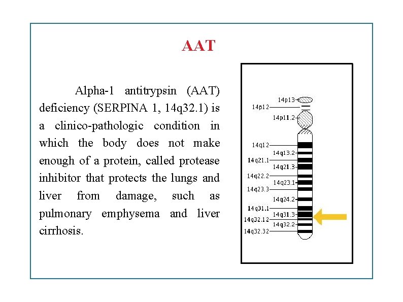 AAT Alpha-1 antitrypsin (AAT) deficiency (SERPINA 1, 14 q 32. 1) is a clinico-pathologic