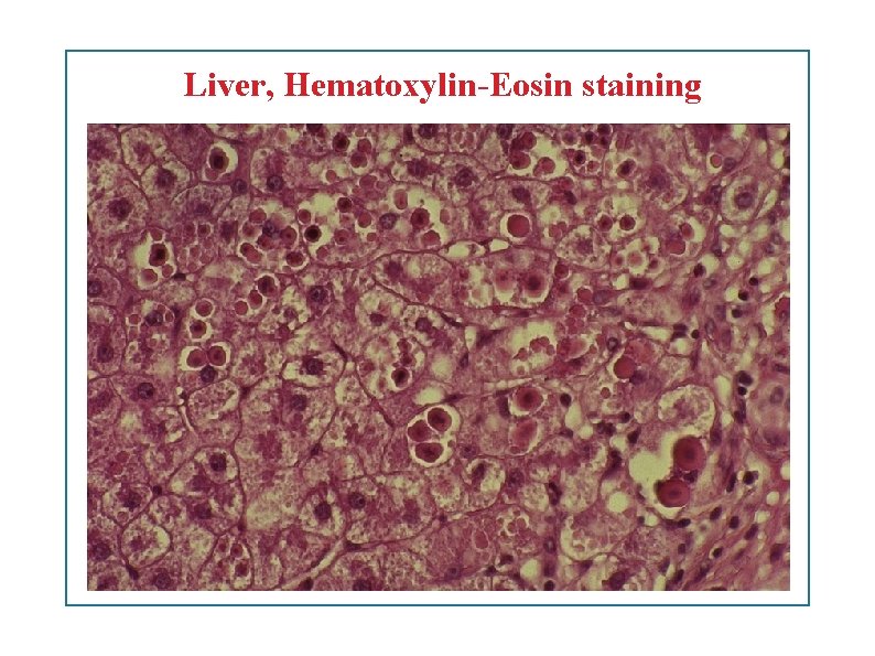 Liver, Hematoxylin-Eosin staining 