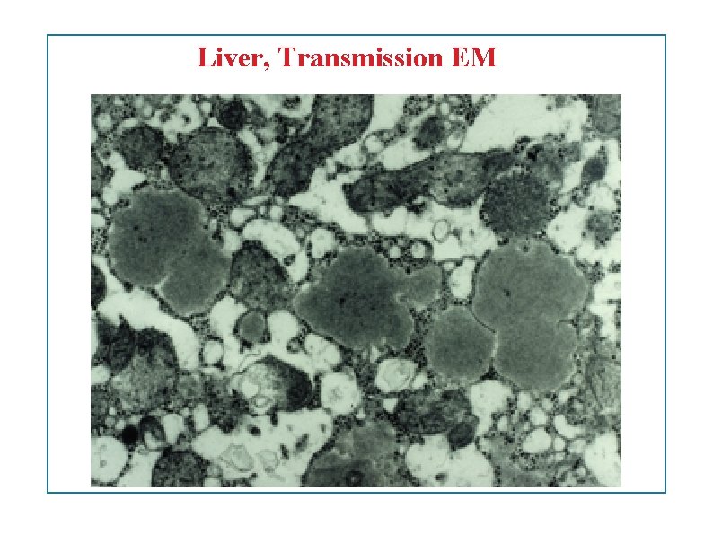 Liver, Transmission EM 