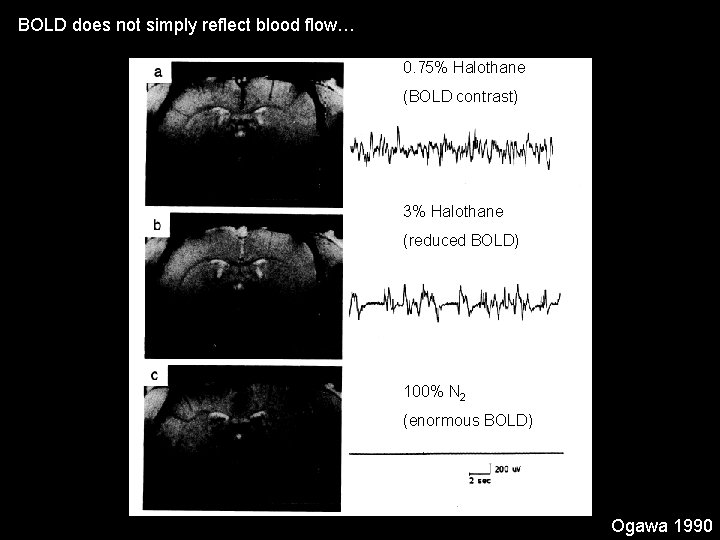 BOLD does not simply reflect blood flow… 0. 75% Halothane (BOLD contrast) 3% Halothane