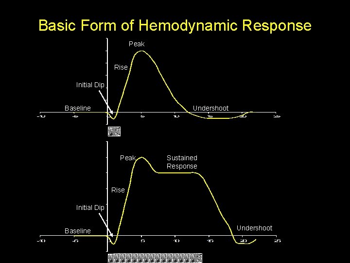 Basic Form of Hemodynamic Response Peak Rise Initial Dip Baseline Undershoot Peak Sustained Response
