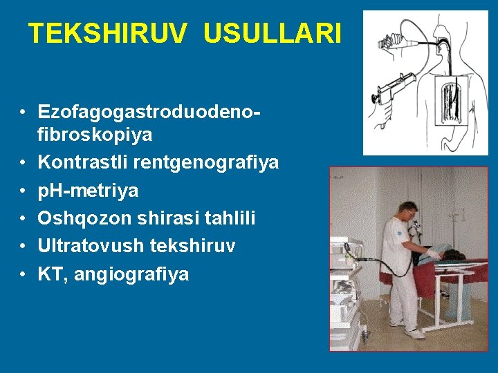 TEKSHIRUV USULLARI • Ezofagogastroduodenofibroskopiya • Kontrastli rentgenografiya • p. H-metriya • Oshqozon shirasi tahlili