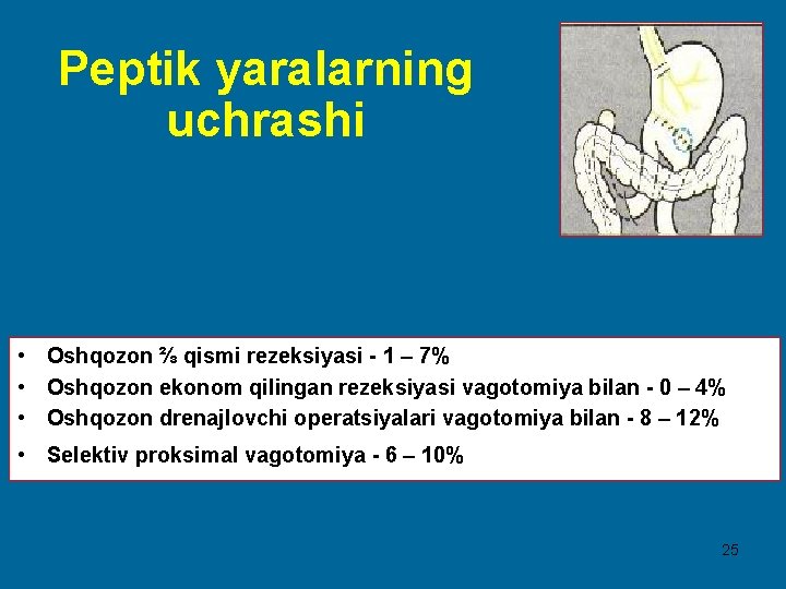 Peptik yaralarning uchrashi • Oshqozon ⅔ qismi rezeksiyasi - 1 – 7% • Oshqozon