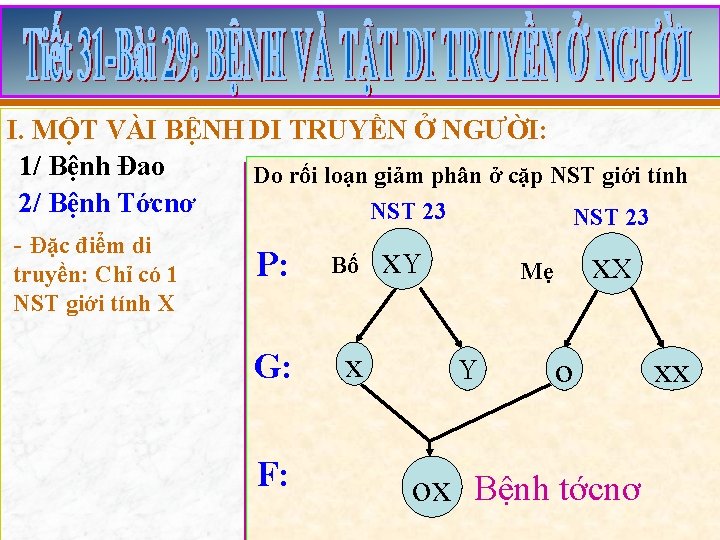 I. MỘT VÀI BỆNH DI TRUYỀN Ở NGƯỜI: 1/ Bệnh Đao Do rối loạn