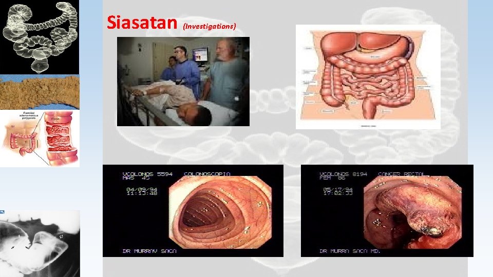 Siasatan (Investigations) 