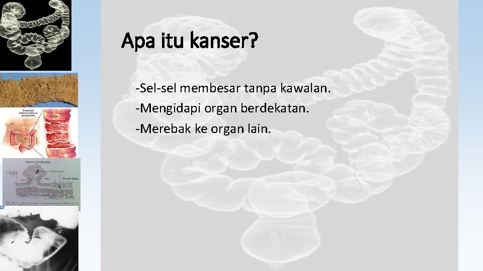 Apa itu kanser? -Sel-sel membesar tanpa kawalan. -Mengidapi organ berdekatan. -Merebak ke organ lain.