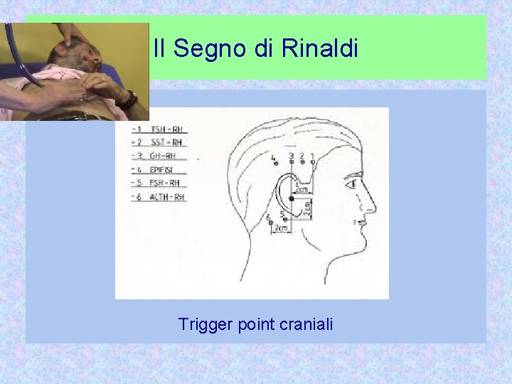 Il Segno di Rinaldi Trigger point craniali 