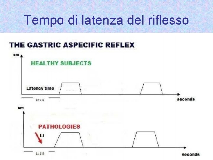 Tempo di latenza del riflesso 