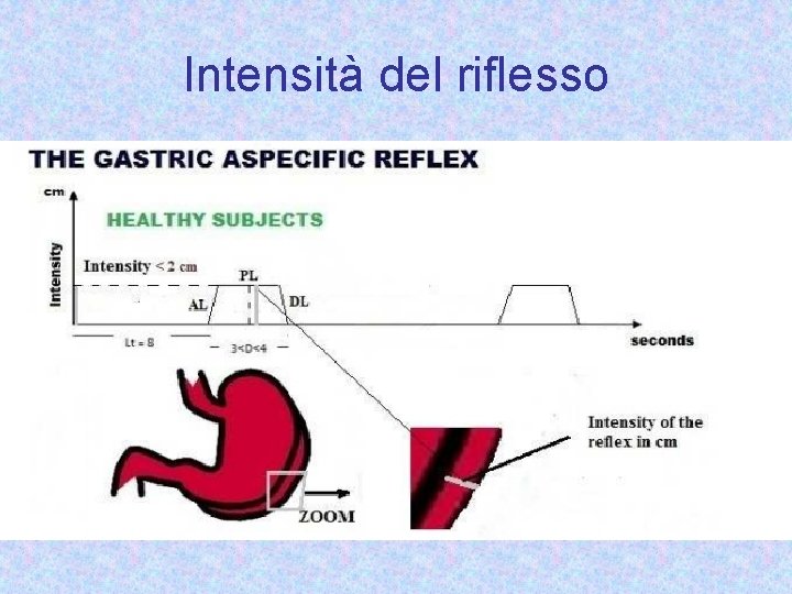 Intensità del riflesso 