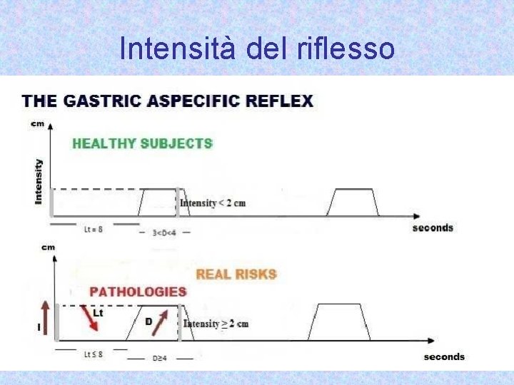 Intensità del riflesso 