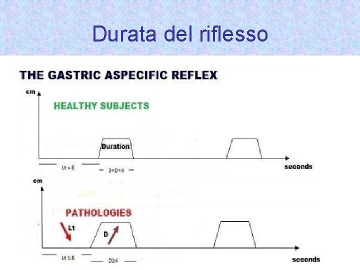 Durata del riflesso 