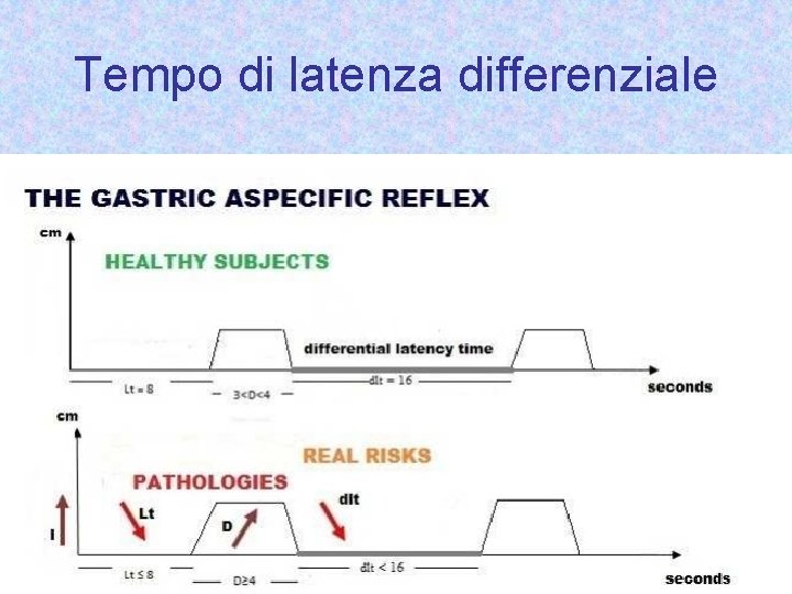 Tempo di latenza differenziale 