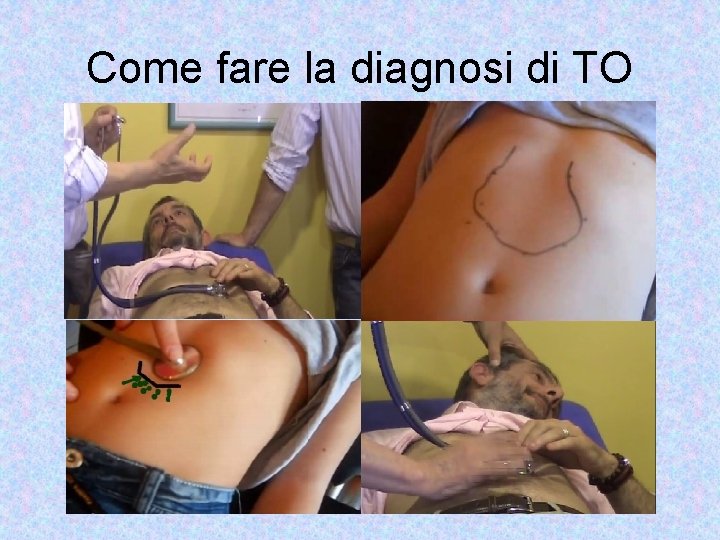 Come fare la diagnosi di TO 