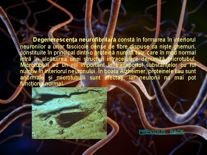 Degenerescenţa neurofibrilară constă în formarea în interiorul neuronilor a unor fascicole dense de fibre
