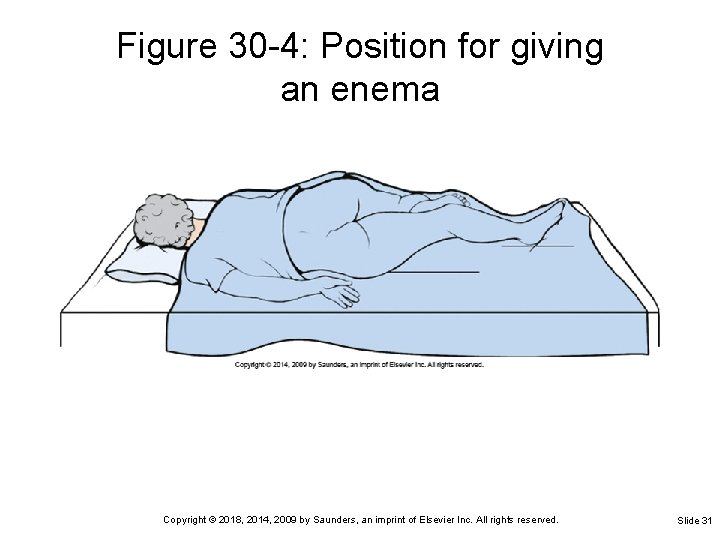 Figure 30 -4: Position for giving an enema Copyright © 2018, 2014, 2009 by