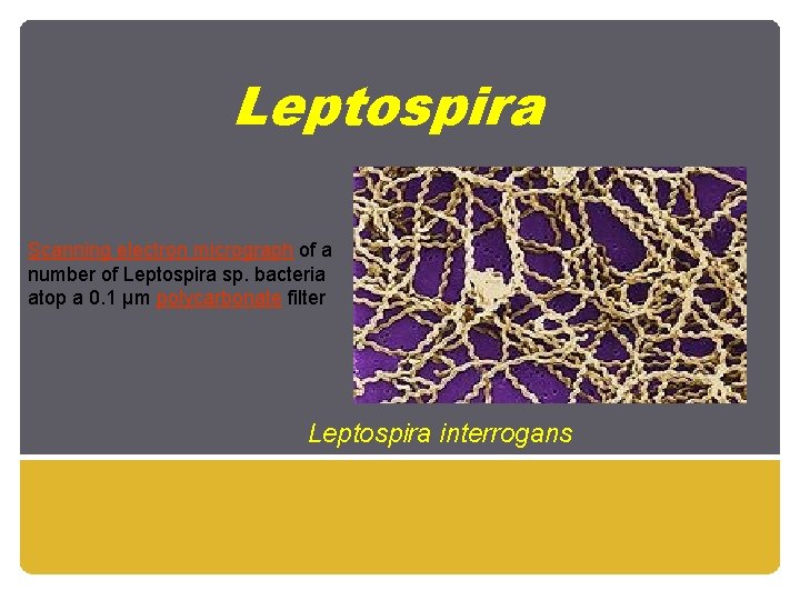 Leptospira Scanning electron micrograph of a number of Leptospira sp. bacteria atop a 0.