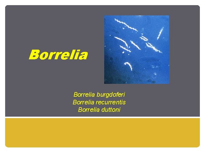 Borrelia burgdoferi Borrelia recurrentis Borrelia duttoni 