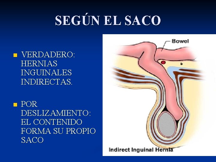 SEGÚN EL SACO n VERDADERO: HERNIAS INGUINALES INDIRECTAS. n POR DESLIZAMIENTO: EL CONTENIDO FORMA