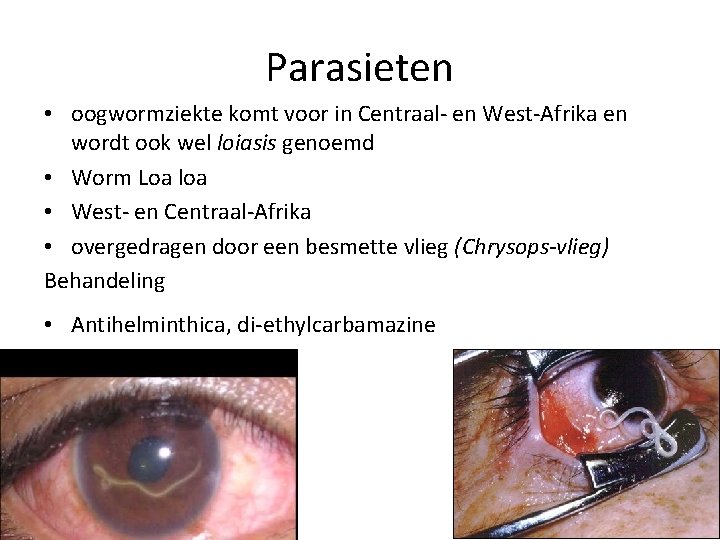 Parasieten • oogwormziekte komt voor in Centraal- en West-Afrika en wordt ook wel loiasis