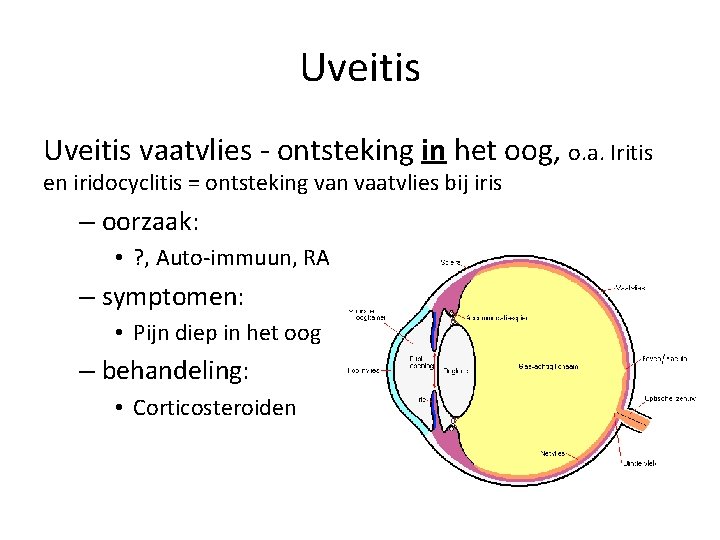 Uveitis vaatvlies - ontsteking in het oog, o. a. Iritis en iridocyclitis = ontsteking