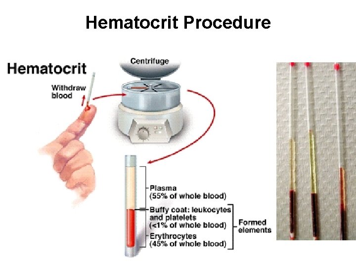 Hematocrit Procedure 