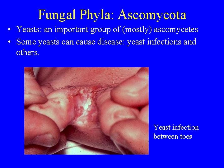Fungal Phyla: Ascomycota • Yeasts: an important group of (mostly) ascomycetes • Some yeasts Fungal Phyla: Ascomycota • Yeasts: an important group of (mostly) ascomycetes • Some yeasts