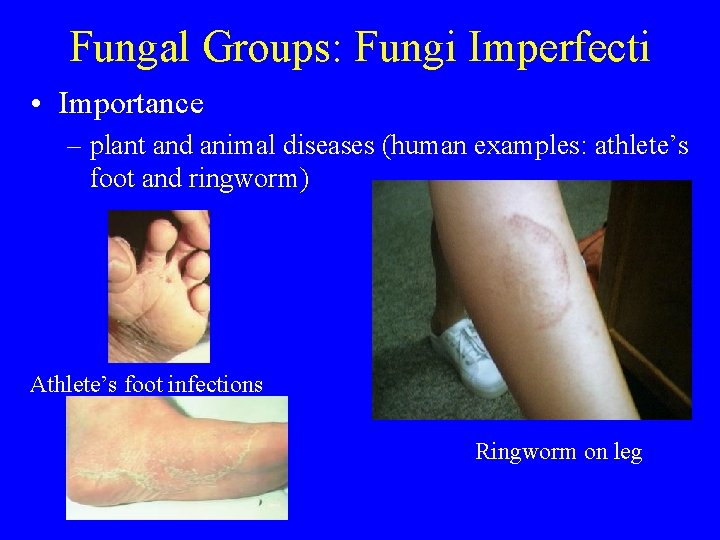 Fungal Groups: Fungi Imperfecti • Importance – plant and animal diseases (human examples: athlete’s Fungal Groups: Fungi Imperfecti • Importance – plant and animal diseases (human examples: athlete’s