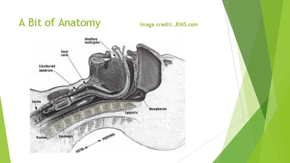 A Bit of Anatomy Image credit: JEMS. com 
