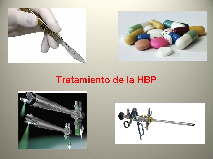 Tratamiento de la HBP 