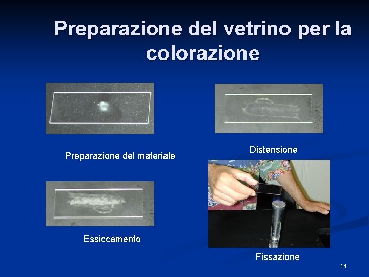 Preparazione del vetrino per la colorazione Preparazione del materiale Distensione Essiccamento Fissazione 14 