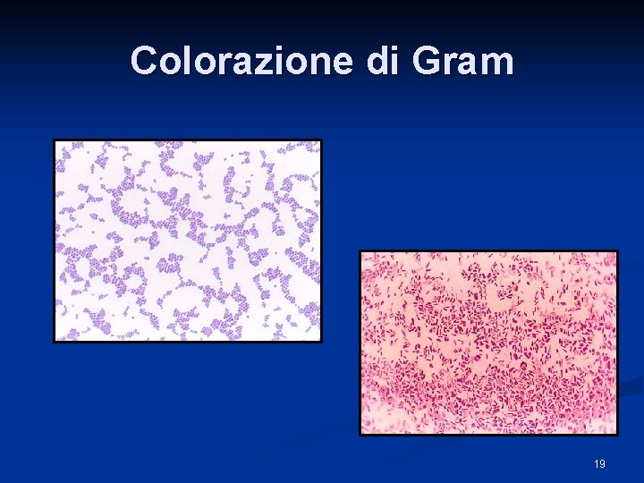 Colorazione di Gram 19 