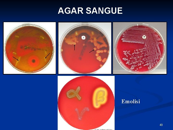 AGAR SANGUE Emolisi 49 