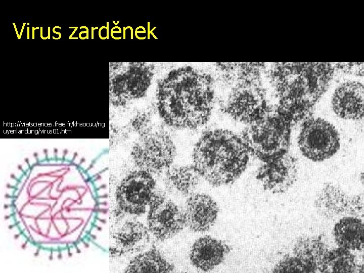 Virus zarděnek http: //vietsciences. free. fr/khaocuu/ng uyenlandung/virus 01. htm 