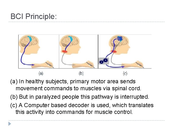 BCI Principle: (a) In healthy subjects, primary motor area sends movement commands to muscles BCI Principle: (a) In healthy subjects, primary motor area sends movement commands to muscles