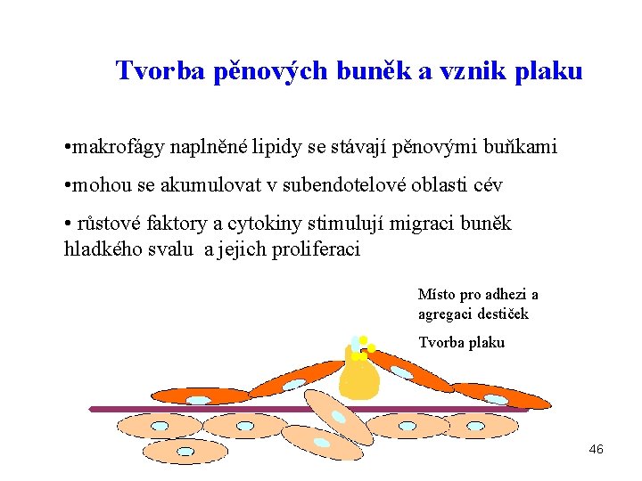 Tvorba pěnových buněk a vznik plaku • makrofágy naplněné lipidy se stávají pěnovými buňkami