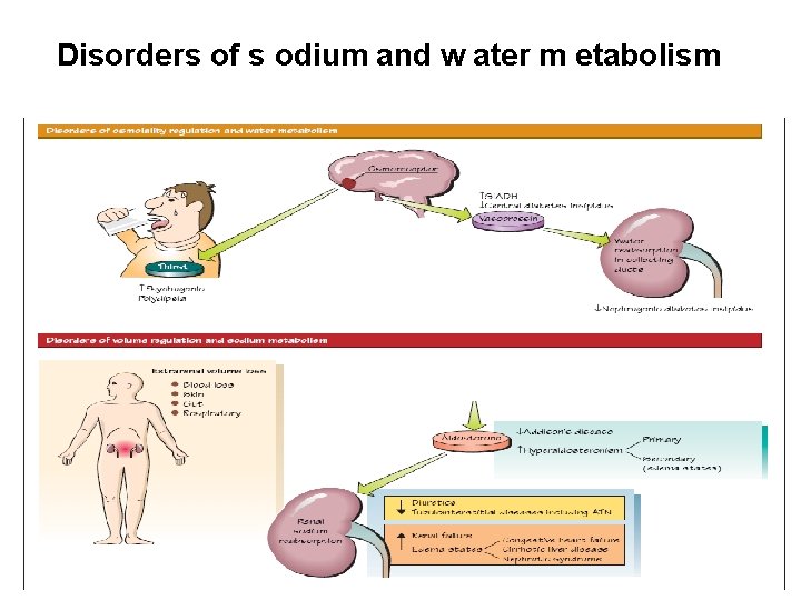 Disorders of s odium and w ater m etabolism 