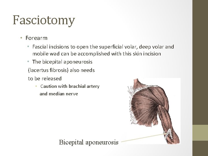 Fasciotomy • Forearm • Fascial incisions to open the superficial volar, deep volar and