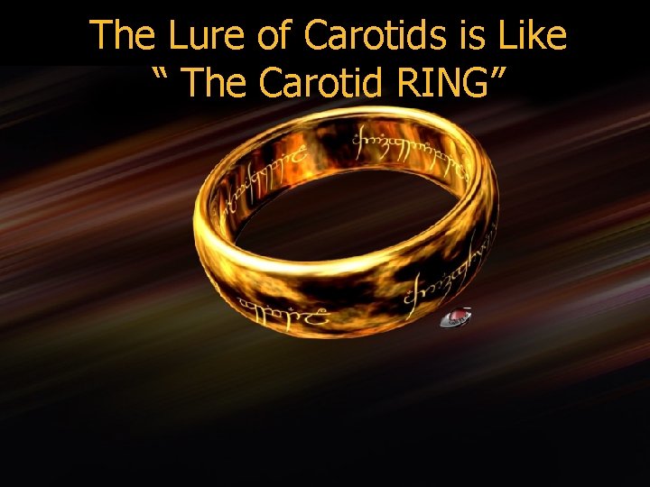 The Lure of Carotids is Like “ The Carotid RING” 