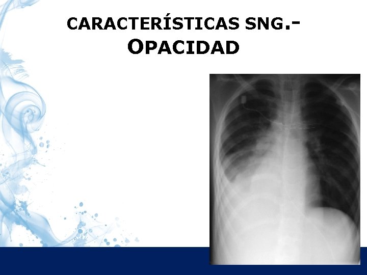 CARACTERÍSTICAS SNG. Características OPACIDAD 