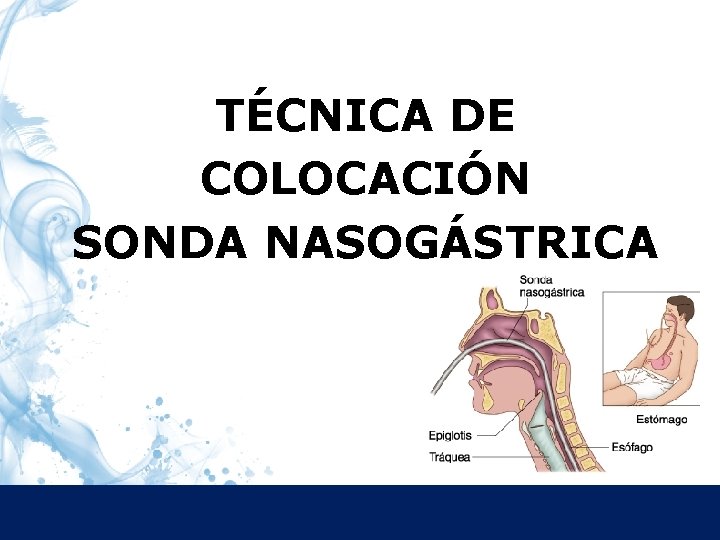 TÉCNICA DE COLOCACIÓN SONDA NASOGÁSTRICA 