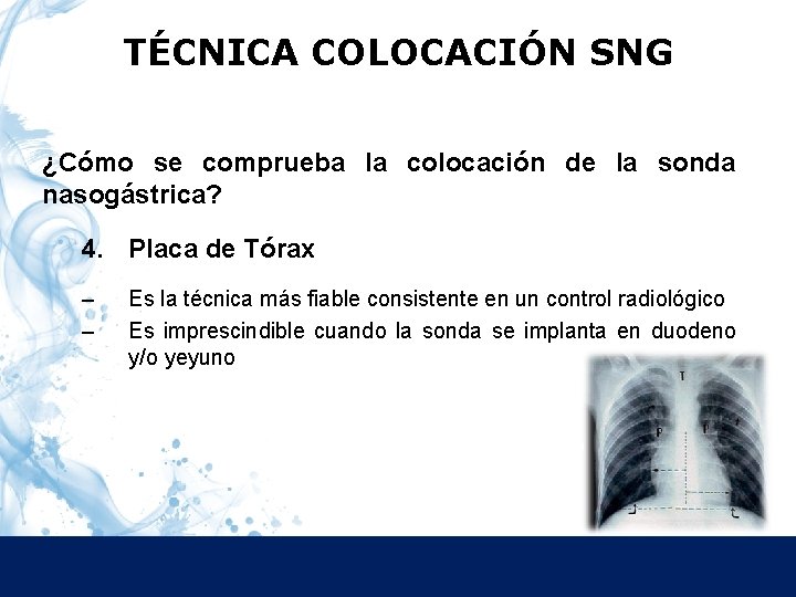 TÉCNICA COLOCACIÓN SNG ¿Cómo se comprueba la colocación de la sonda nasogástrica? 4. Placa