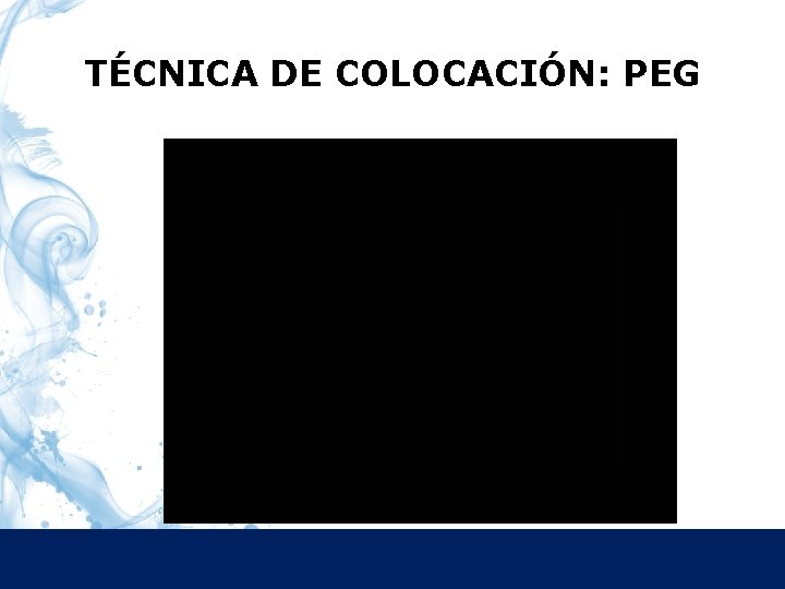 TÉCNICA DE COLOCACIÓN: PEG 