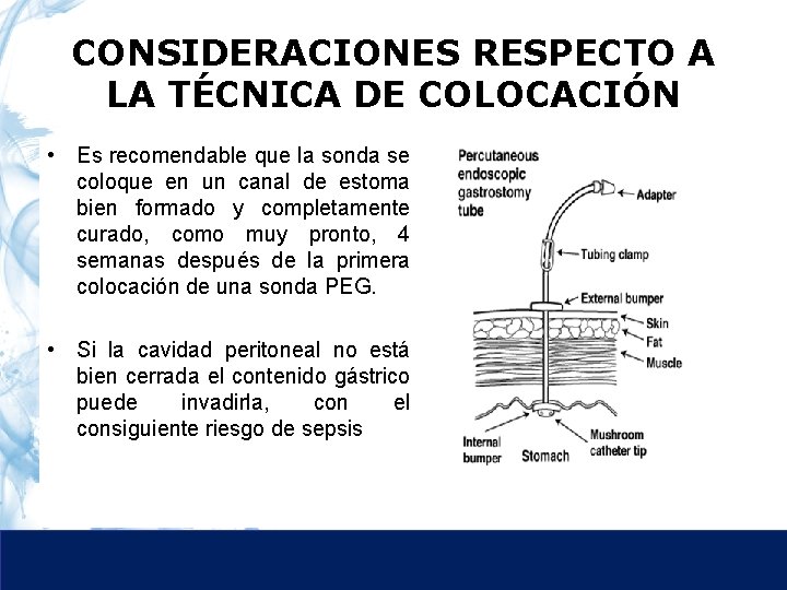 CONSIDERACIONES RESPECTO A LA TÉCNICA DE COLOCACIÓN • Es recomendable que la sonda se