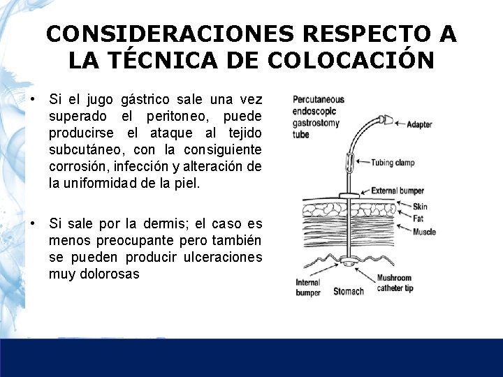 CONSIDERACIONES RESPECTO A LA TÉCNICA DE COLOCACIÓN • Si el jugo gástrico sale una