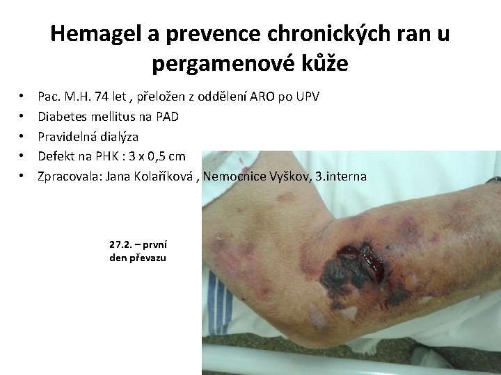 Hemagel a prevence chronických ran u pergamenové kůže • • • Pac. M. H.